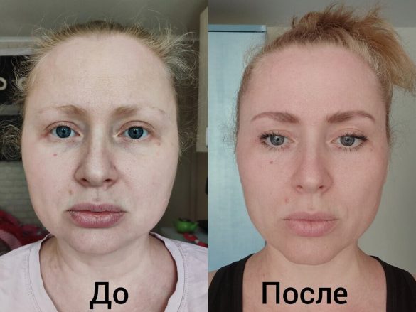 1b8ed7fb9213be5c802ff9ba4c428dde фейсфитнес для лица до и после